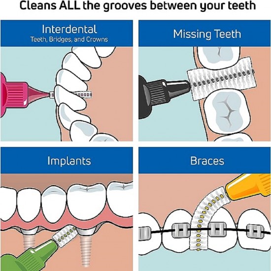 تيبي فرشاة تنظيف ما بين الأسنان اي دي بي اورانج بليستر - 0.45 ملم - 6 قطع